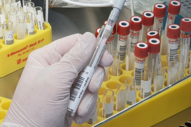 Der Abstrich von Fabio Wagner wird für einen PCR-Test vorbereitet. 